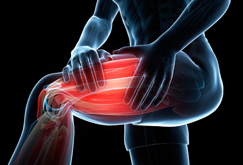 3. Polymyalgia Rheumatica: A Common Cause of Muscle Pain